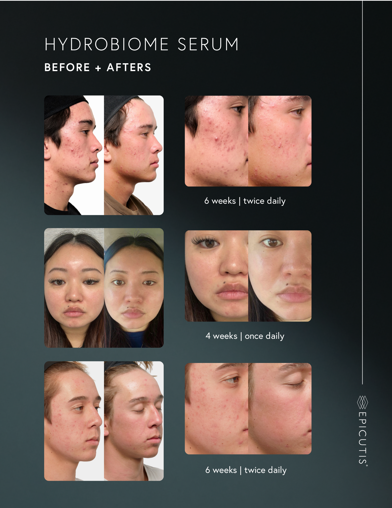 Hydrobiome Serum before and after results — 4–6 weeks use