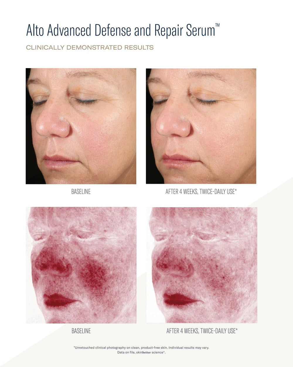 Alto Advanced Defence & Repair Serum