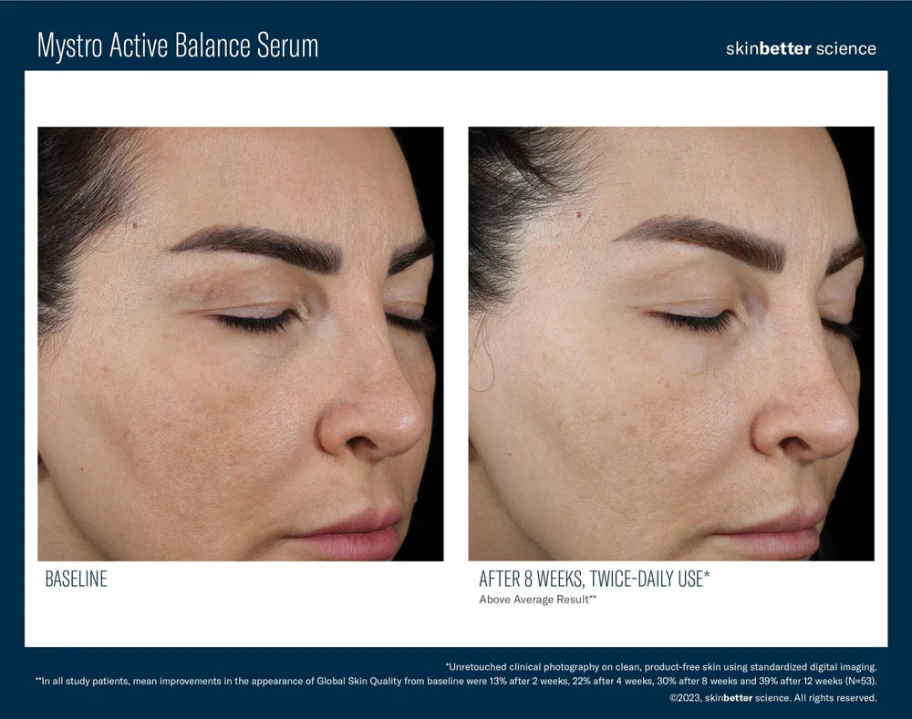 Mystro Active Balance Serum
