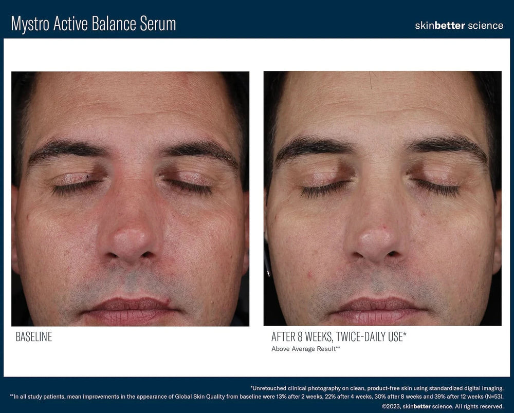 Mystro Active Balance Serum