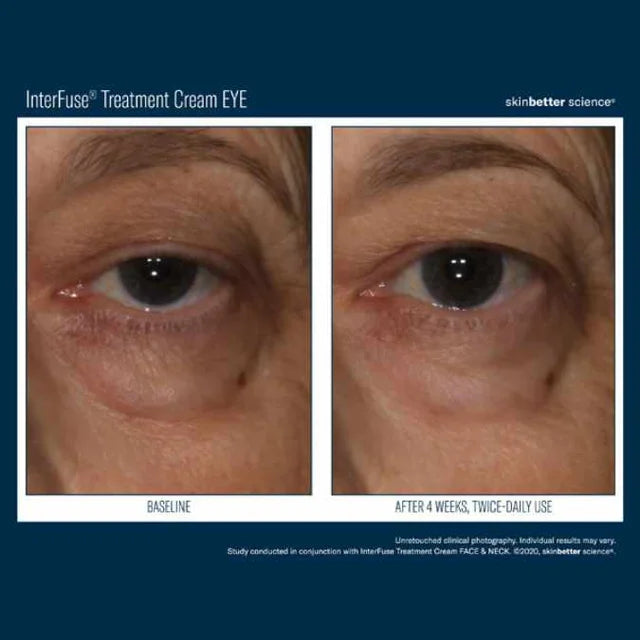 SkinBetter Science Interfuse Treatment Cream EYE, 15ml