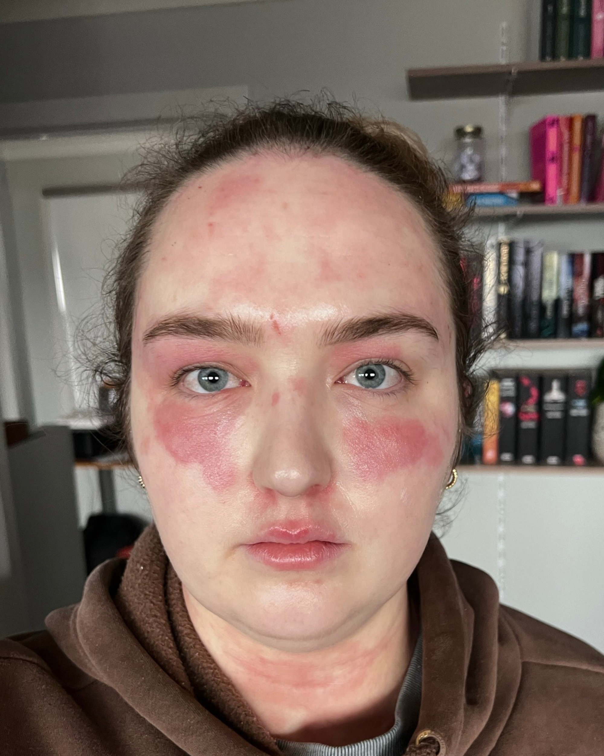skin laser clinic canberra