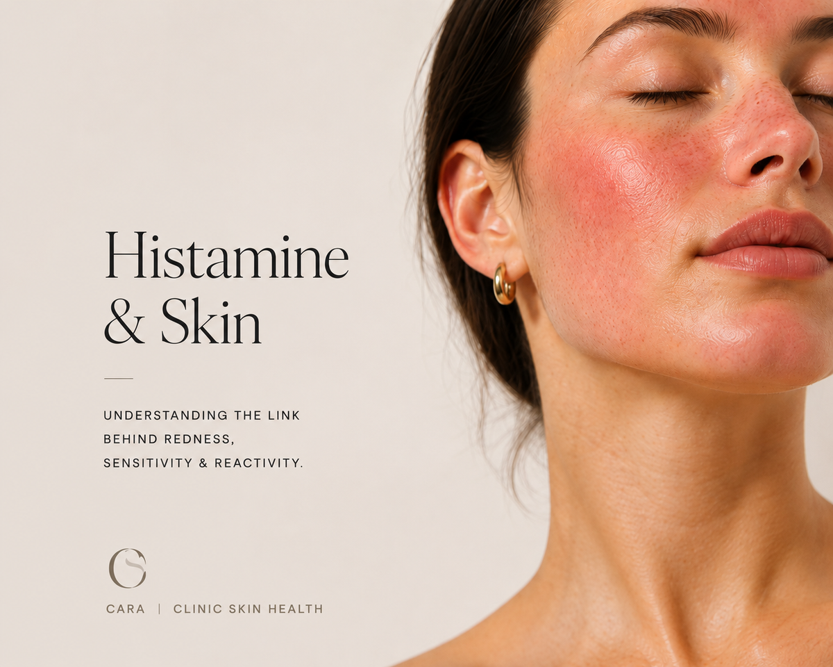 Histamine and Your Skin: Why You Flush, Itch and Welt — and What Actually Helps