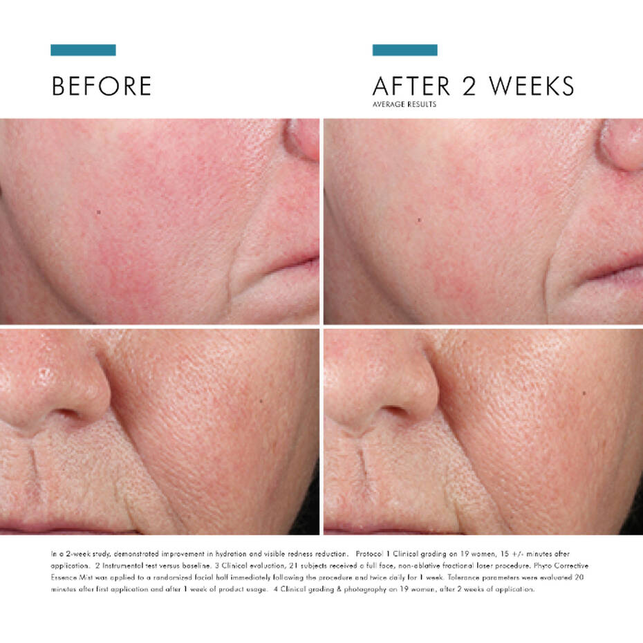 Phyto Corrective Essence Hydrating Mist