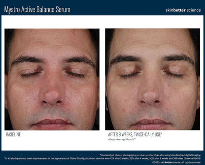 Mystro Active Balance Serum